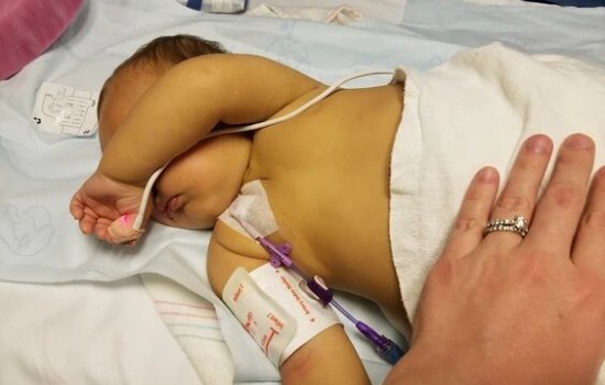 After the liver biopsy