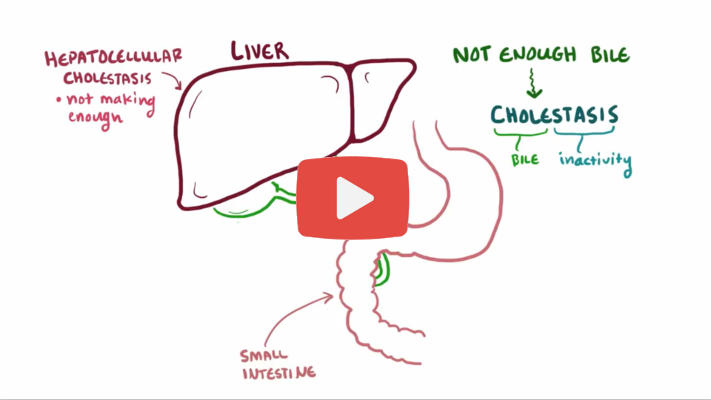 video with more about cholestasis